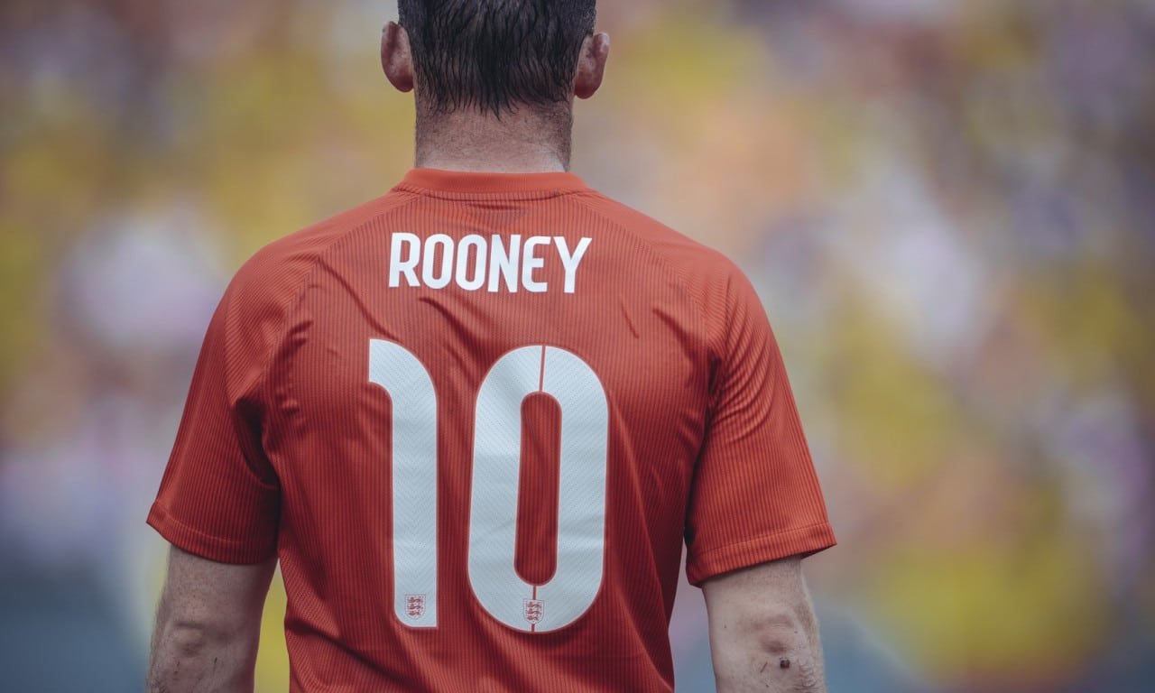 Footballers with Hair Transplants