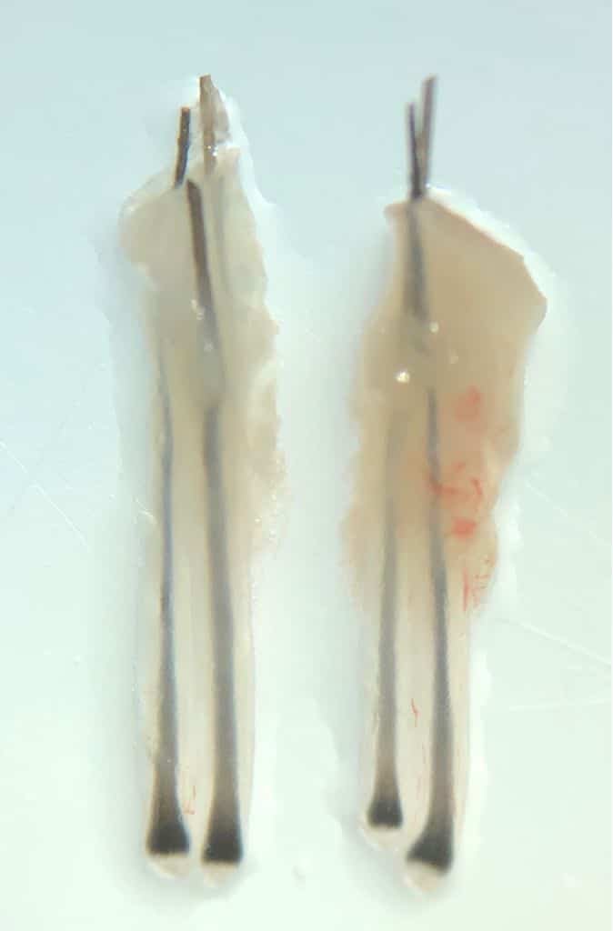 What are Follicular Units?