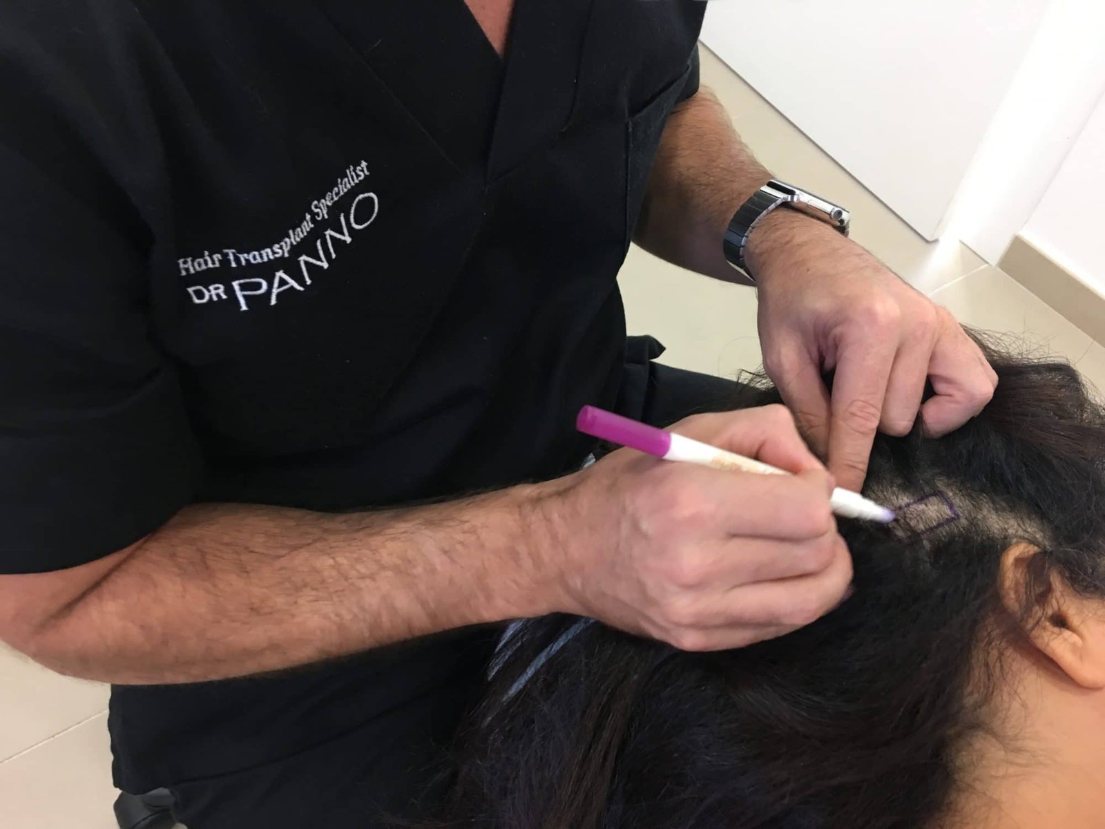 Conociendo El Injerto Capilar Con Implanter