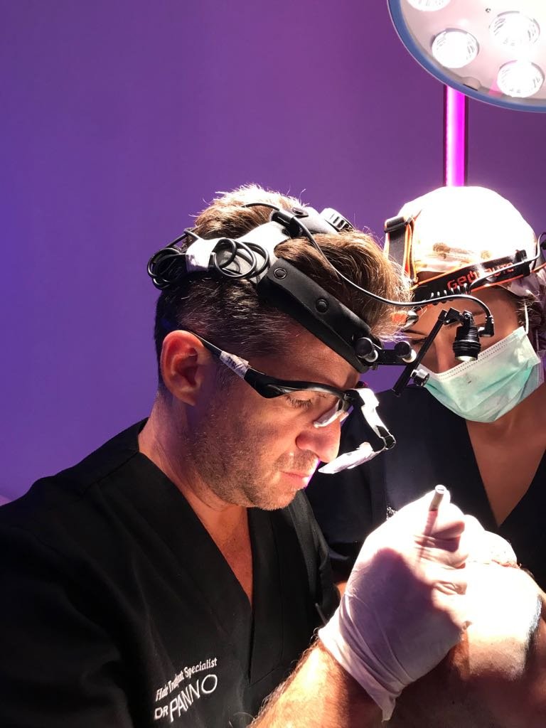 Capillary grafting Technique : nanoFUE