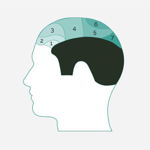 injerto capilar area diagram