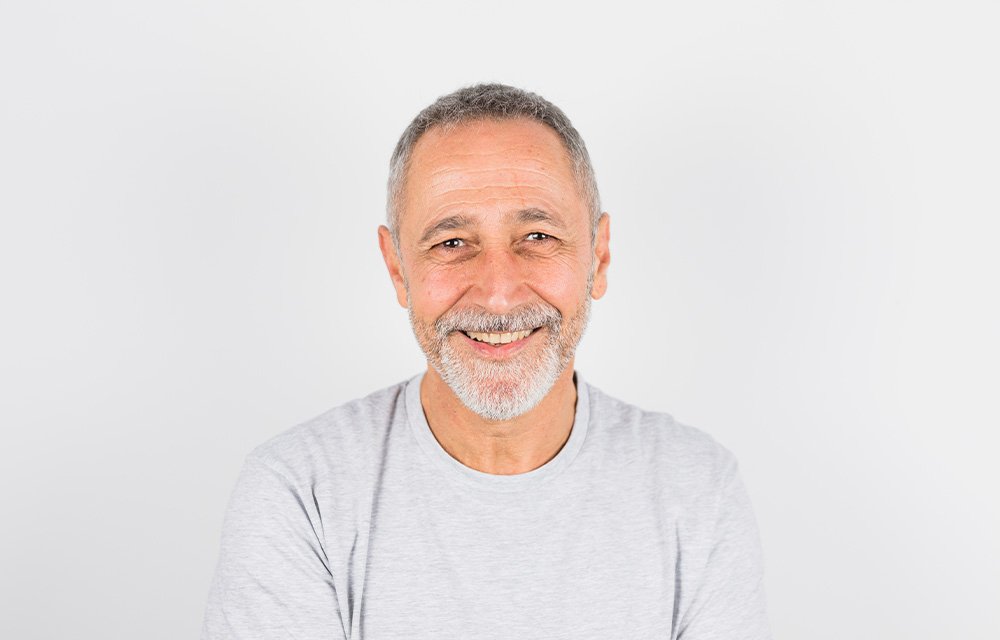 Las canas y la alopecia