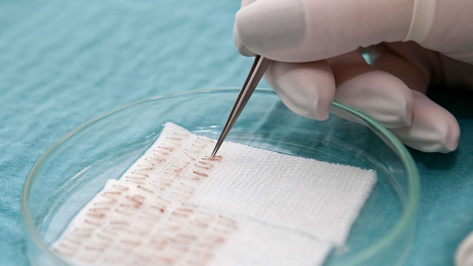 Folículos ilimitados, ¿es posible?