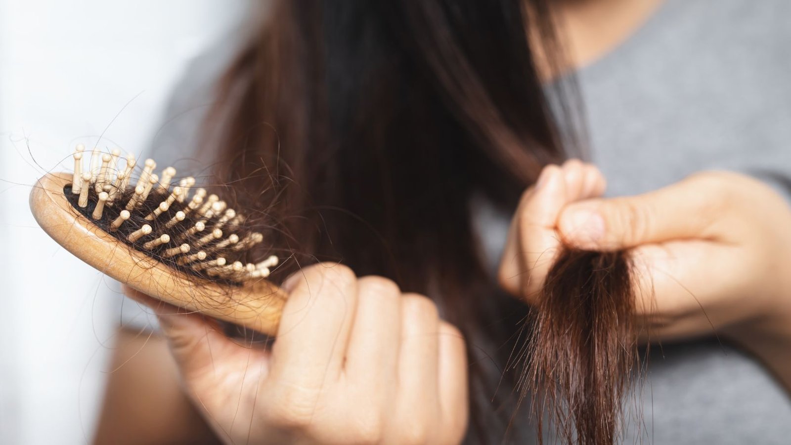 Alternativas no quirúrgicas para tratar la pérdida de cabello