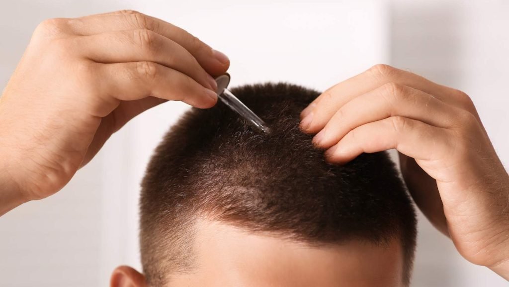 la-verdad-sobre-el-finasteride