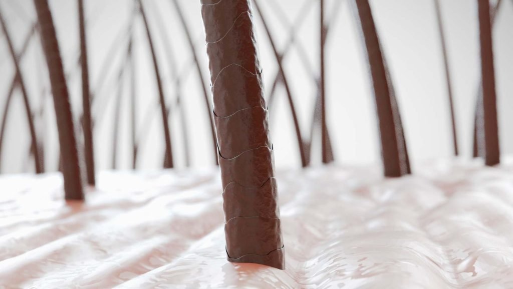 Microinjertos-capilares