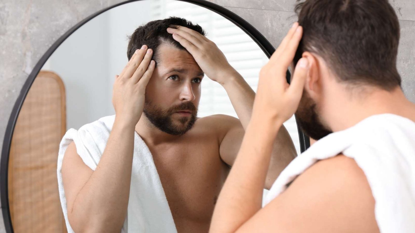 ¿Cuál es la mejor edad para un injerto capilar?